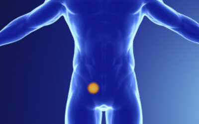 Βουβωνοκήλη