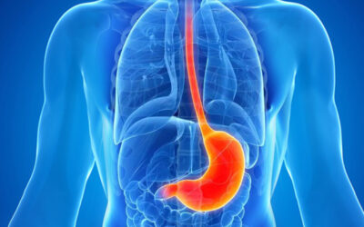 Γαστροοισοφαγική Παλινδρόμηση