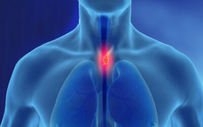 Καρκίνος Οισοφάγου