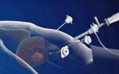 Λαπαροσκοπική Χειρουργική